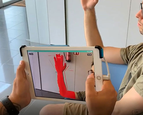 tutore photocentric stampa 3d